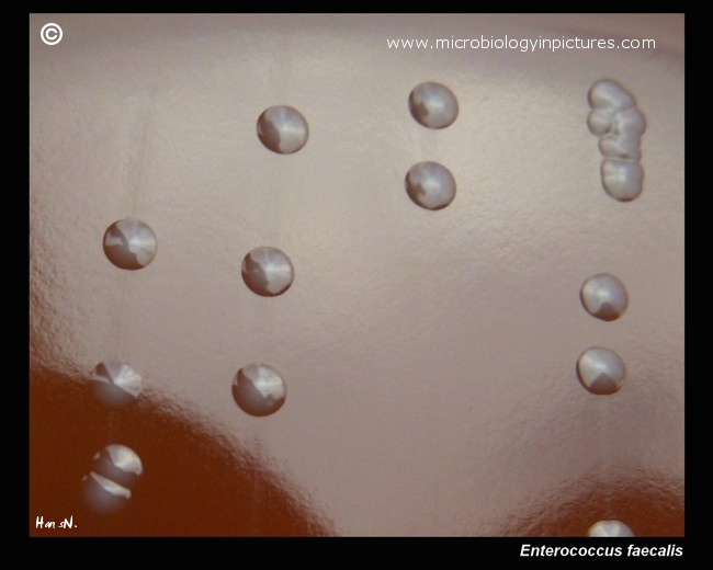 Enterococcus faecalis colony morphology description